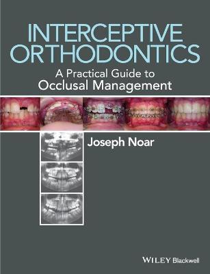 Interceptive Orthodontics - A Practical Guide to Occlusal Management